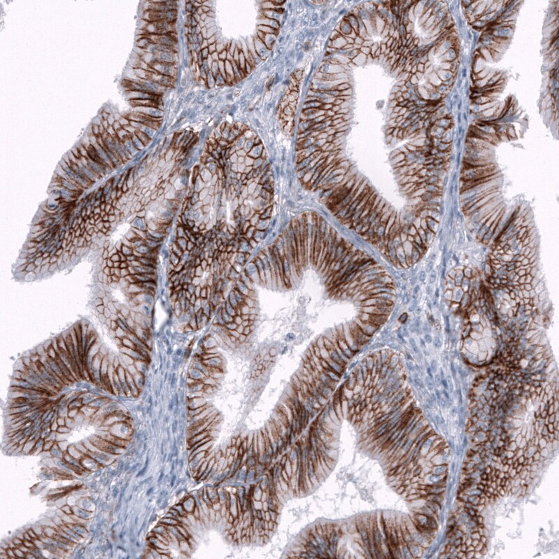 CD44 Antibody (CL13324) - Azide and BSA Free Immunohistochemistry-Paraffin: CD44 Antibody [NBP3-44375]