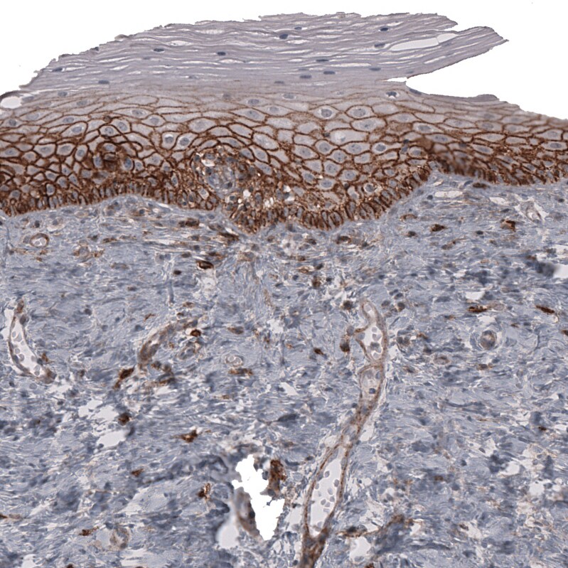 CD44 Antibody (CL13324) - Azide and BSA Free Immunohistochemistry-Paraffin: CD44 Antibody [NBP3-44375]