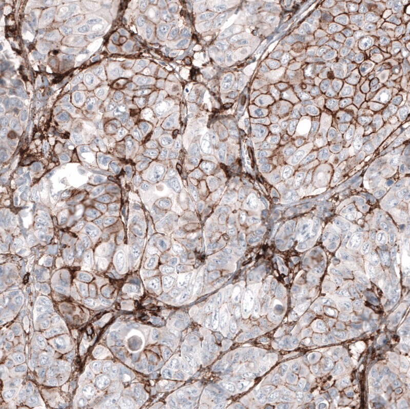 CD44 Antibody (CL13319) - Azide and BSA Free Immunohistochemistry-Paraffin: CD44 Antibody [NBP3-44376]