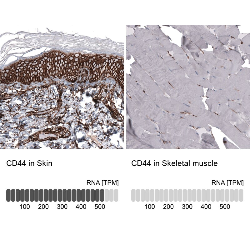 CD44 Antibody (CL13319) - Azide and BSA Free Immunohistochemistry-Paraffin: CD44 Antibody [NBP3-44376]