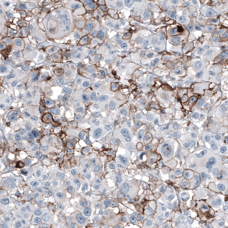 CD44 Antibody (CL13319) - Azide and BSA Free Immunohistochemistry-Paraffin: CD44 Antibody [NBP3-44376]