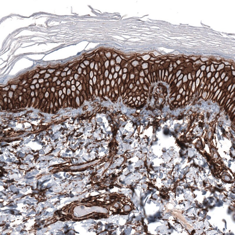CD44 Antibody (CL13319) - Azide and BSA Free Immunohistochemistry-Paraffin: CD44 Antibody [NBP3-44376]
