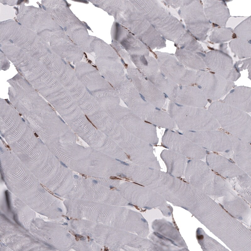 CD44 Antibody (CL13319) - Azide and BSA Free Immunohistochemistry-Paraffin: CD44 Antibody [NBP3-44376]