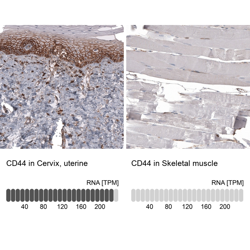 CD44 Antibody (CL13318) - Azide and BSA Free Immunohistochemistry-Paraffin: CD44 Antibody [NBP3-44377]