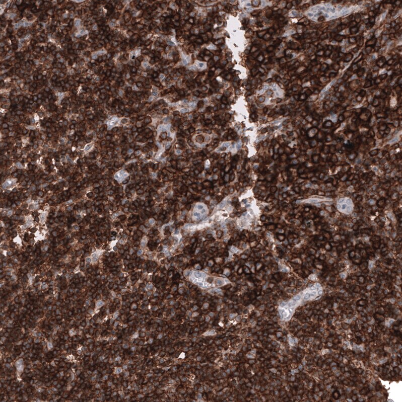 CD44 Antibody (CL13318) - Azide and BSA Free Immunohistochemistry-Paraffin: CD44 Antibody [NBP3-44377]
