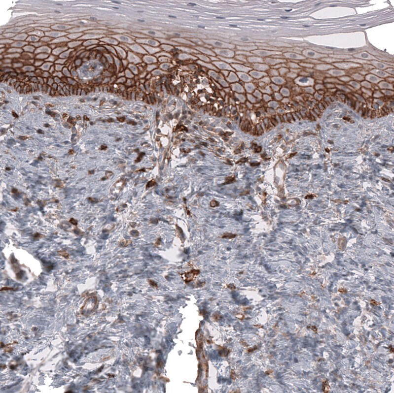 CD44 Antibody (CL13318) - Azide and BSA Free Immunohistochemistry-Paraffin: CD44 Antibody [NBP3-44377]