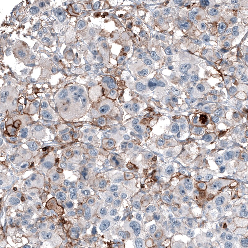 CD44 Antibody (CL13318) - Azide and BSA Free Immunohistochemistry-Paraffin: CD44 Antibody [NBP3-44377]