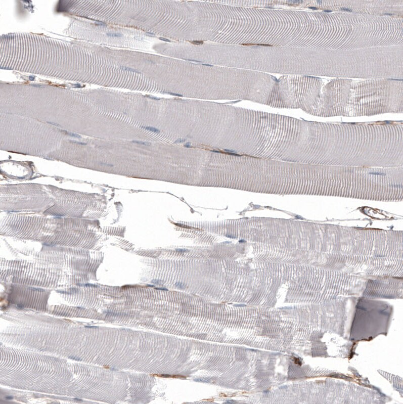 CD44 Antibody (CL13318) - Azide and BSA Free Immunohistochemistry-Paraffin: CD44 Antibody [NBP3-44377]
