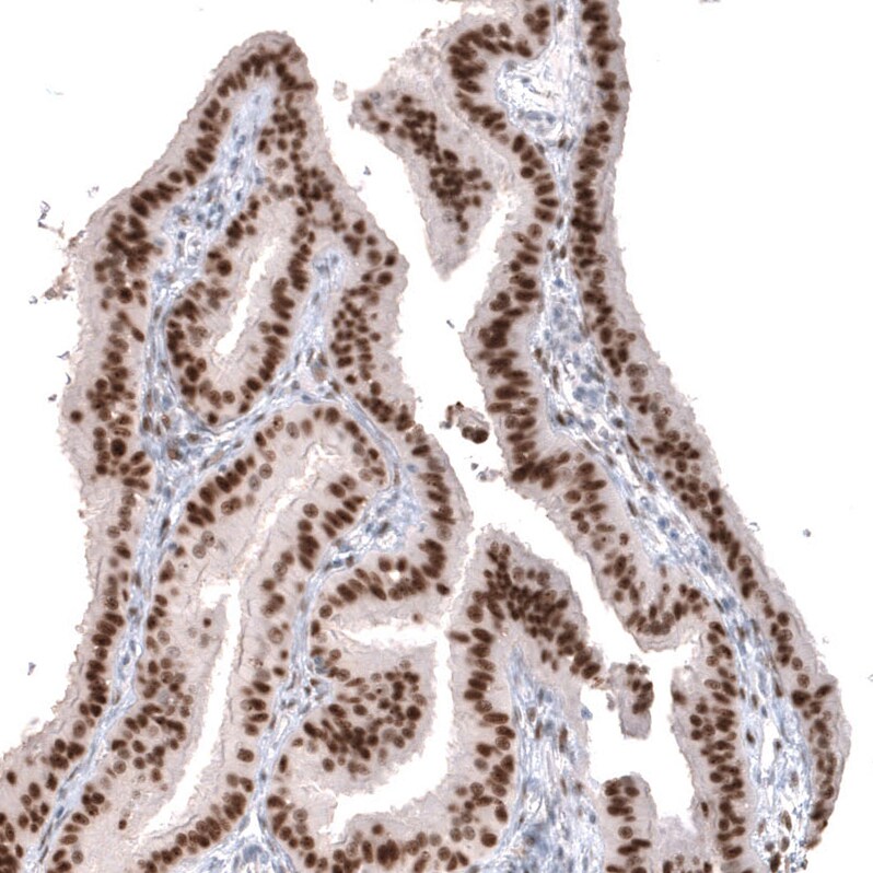 WT1 Antibody (CL13170) - Azide and BSA Free Immunohistochemistry-Paraffin: WT1 Antibody [NBP3-44378]