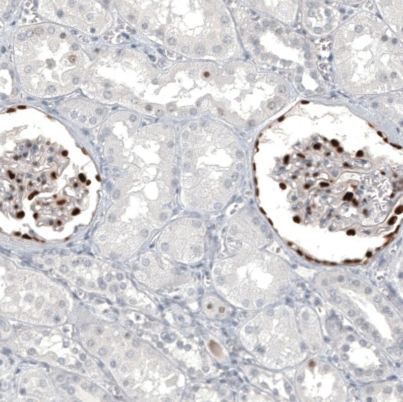 WT1 Antibody (CL13170) - Azide and BSA Free Immunohistochemistry-Paraffin: WT1 Antibody [NBP3-44378]