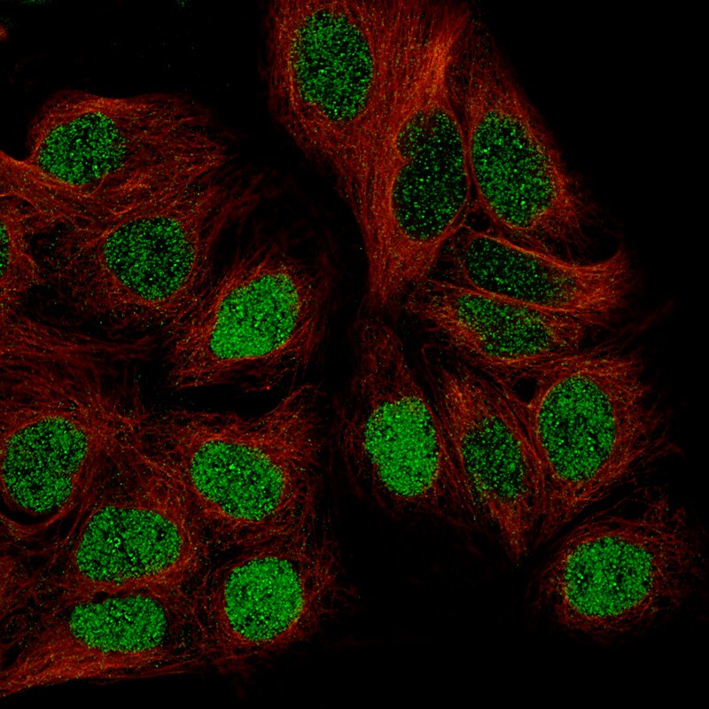 WT1 Antibody (CL13170) - Azide and BSA Free Immunocytochemistry/ Immunofluorescence: WT1 Antibody [NBP3-44378]
