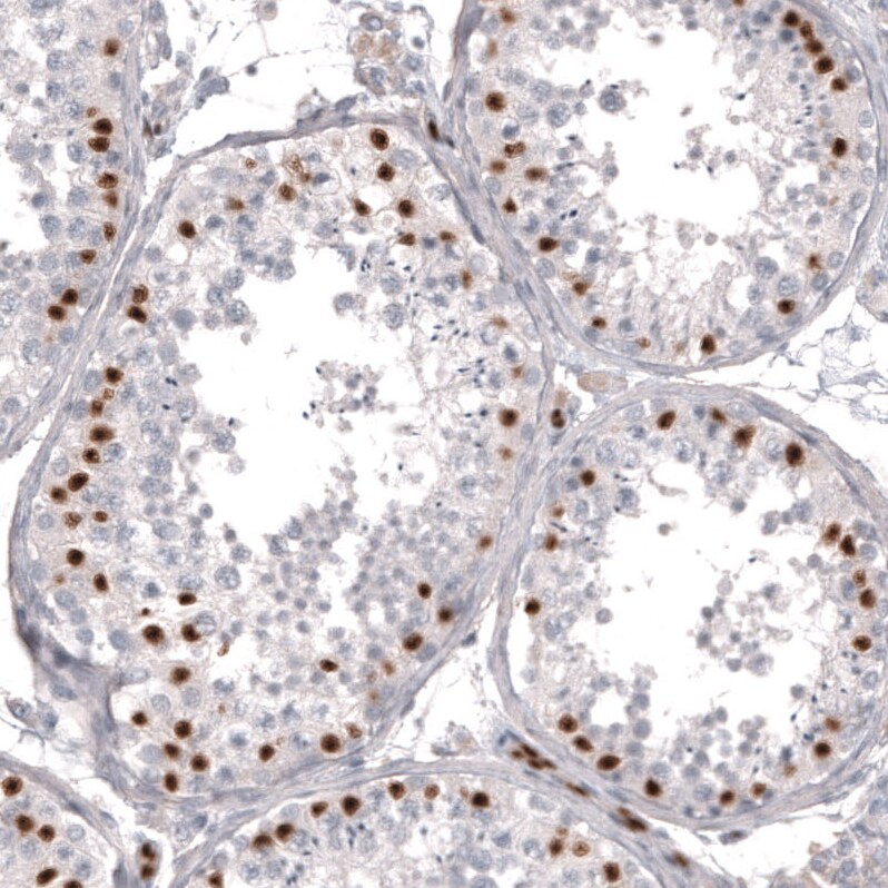 WT1 Antibody (CL13170) - Azide and BSA Free Immunohistochemistry-Paraffin: WT1 Antibody [NBP3-44378]