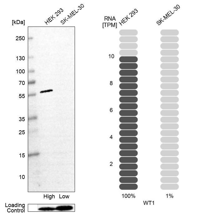 WT1 Antibody (CL13170) - Azide and BSA Free Western Blot: WT1 Antibody [NBP3-44378]