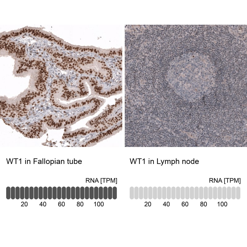 WT1 Antibody (CL13165) - Azide and BSA Free Immunohistochemistry-Paraffin: WT1 Antibody [NBP3-44379]