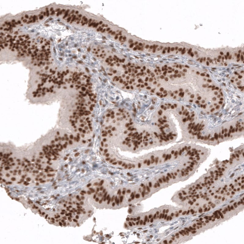 WT1 Antibody (CL13165) - Azide and BSA Free Immunohistochemistry-Paraffin: WT1 Antibody [NBP3-44379]