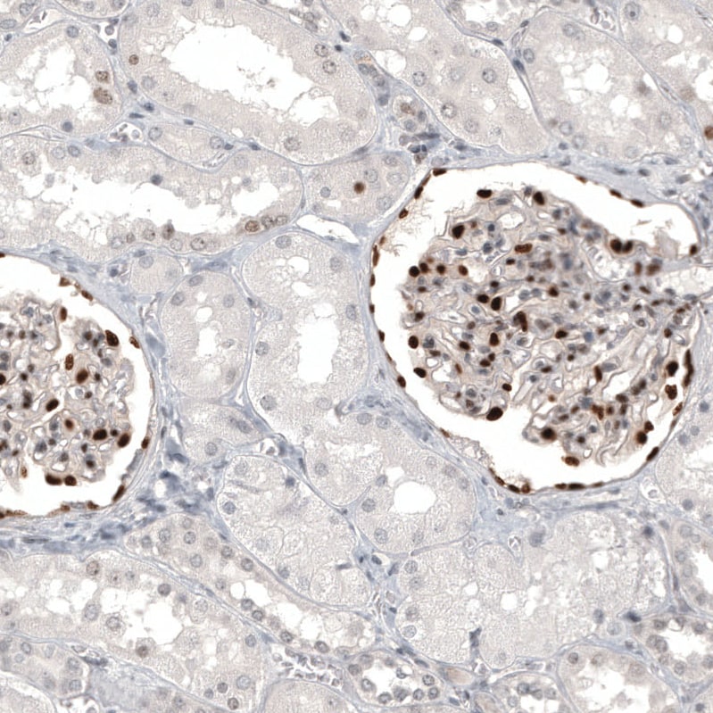 WT1 Antibody (CL13165) - Azide and BSA Free Immunohistochemistry-Paraffin: WT1 Antibody [NBP3-44379]