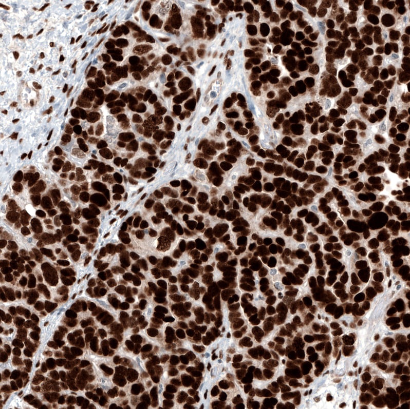 WT1 Antibody (CL13165) - Azide and BSA Free Immunohistochemistry-Paraffin: WT1 Antibody [NBP3-44379]
