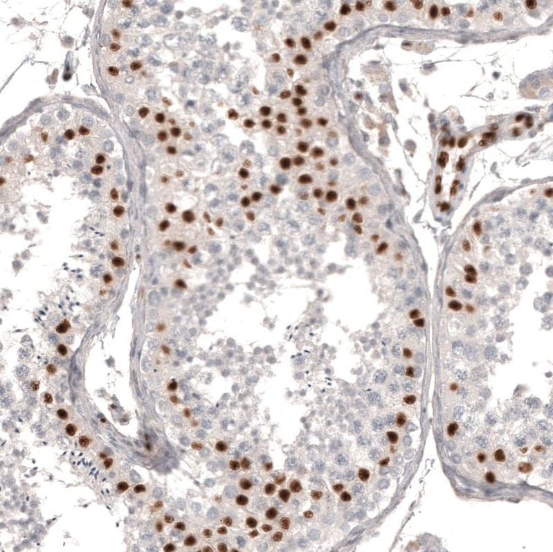 WT1 Antibody (CL13165) - Azide and BSA Free Immunohistochemistry-Paraffin: WT1 Antibody [NBP3-44379]