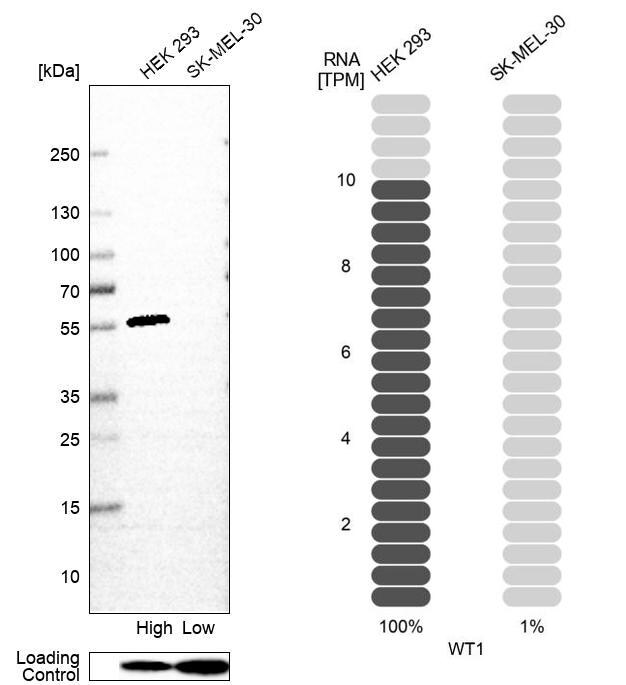 WT1 Antibody (CL13165) - Azide and BSA Free Western Blot: WT1 Antibody [NBP3-44379]