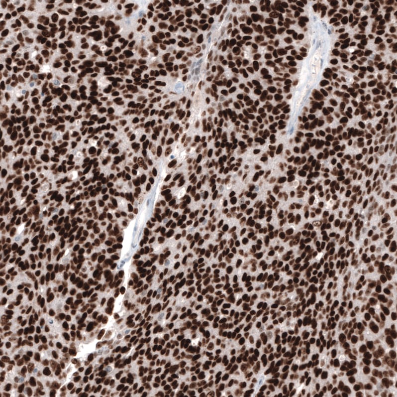 WT1 Antibody (CL13165) - Azide and BSA Free Immunohistochemistry-Paraffin: WT1 Antibody [NBP3-44379]
