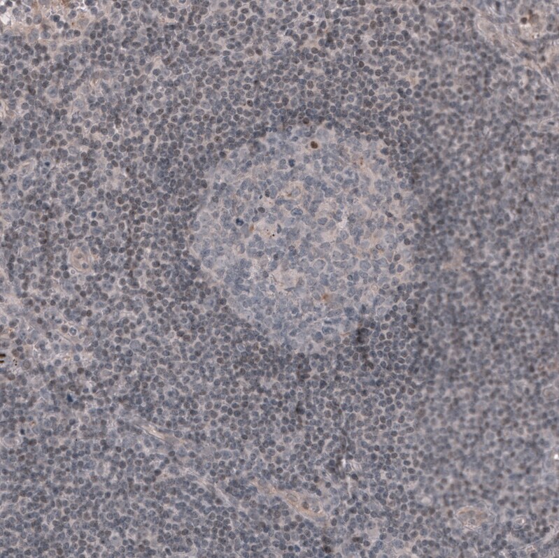 WT1 Antibody (CL13165) - Azide and BSA Free Immunohistochemistry-Paraffin: WT1 Antibody [NBP3-44379]