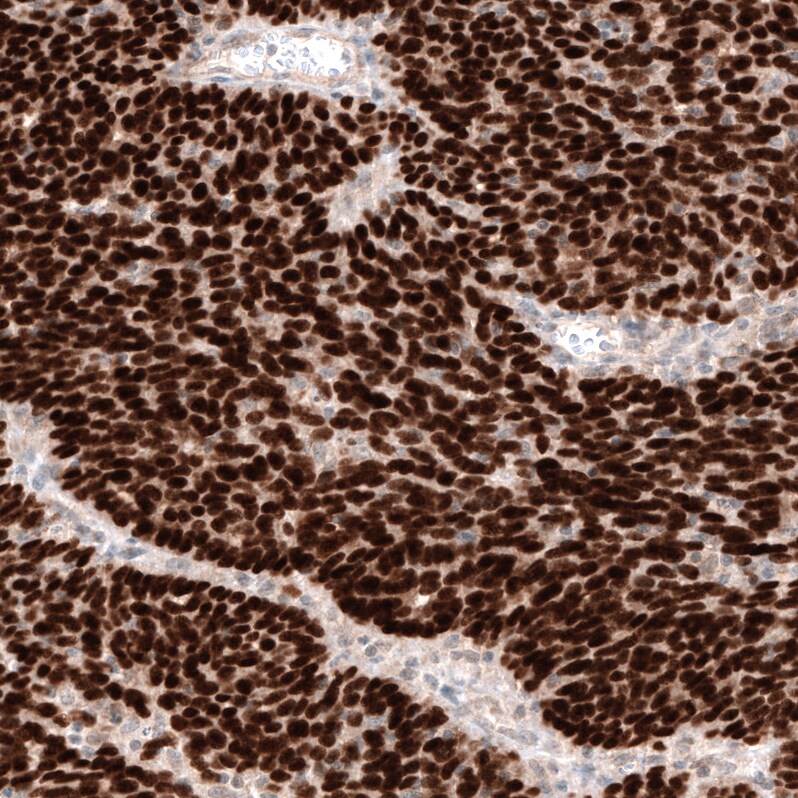 WT1 Antibody (CL13165) - Azide and BSA Free Immunohistochemistry-Paraffin: WT1 Antibody [NBP3-44379]