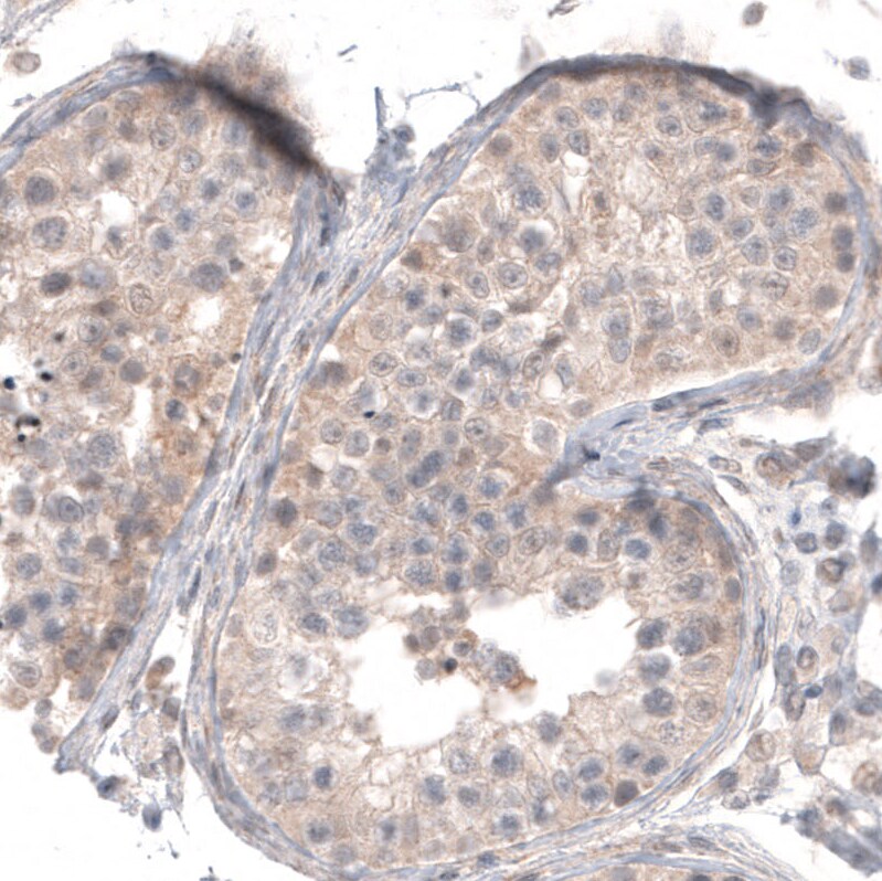 CD30/TNFRSF8 Antibody (CL12632) - Azide and BSA Free Immunohistochemistry-Paraffin: CD30/TNFRSF8 Antibody [NBP3-44380]