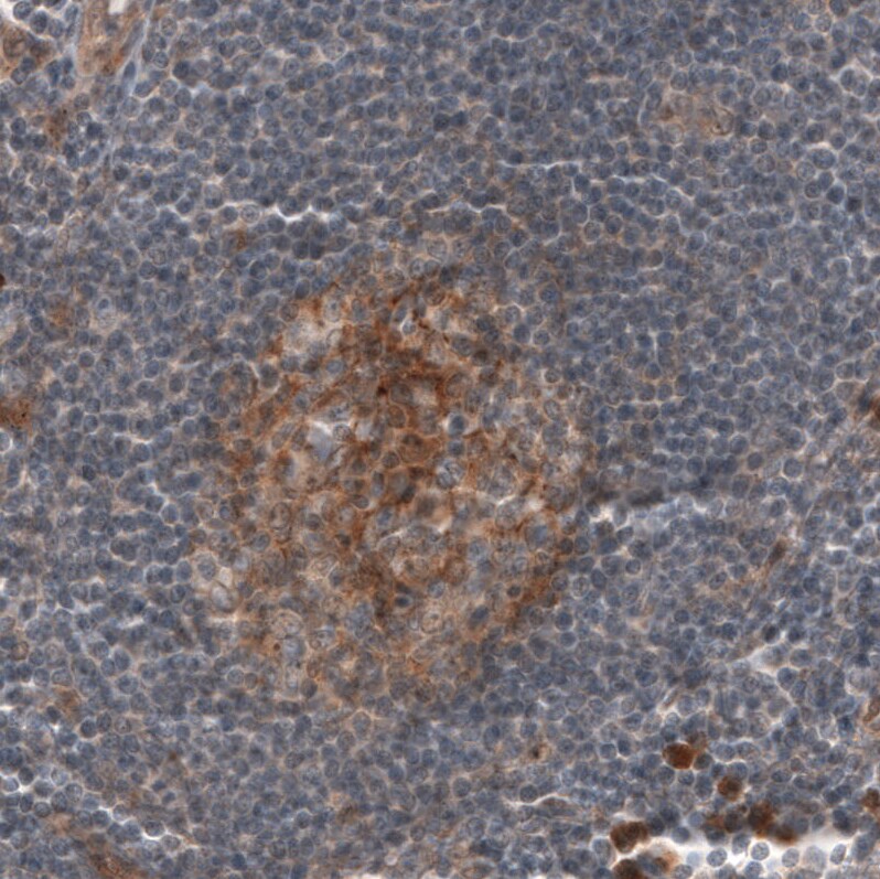 CD30/TNFRSF8 Antibody (CL12632) - Azide and BSA Free Immunohistochemistry-Paraffin: CD30/TNFRSF8 Antibody [NBP3-44380]