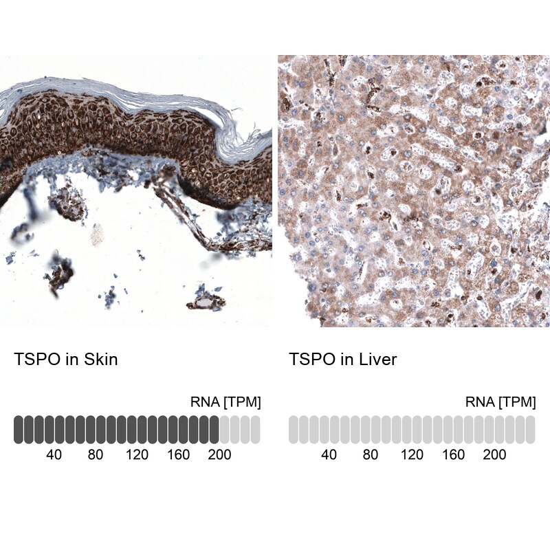 PBR Antibody (CL13358) - Azide and BSA Free Immunohistochemistry-Paraffin: PBR Antibody [NBP3-44381]