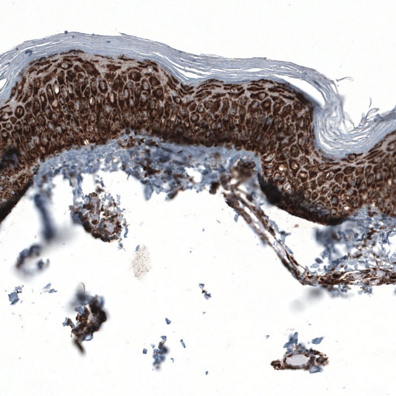 PBR Antibody (CL13358) - Azide and BSA Free Immunohistochemistry-Paraffin: PBR Antibody [NBP3-44381]