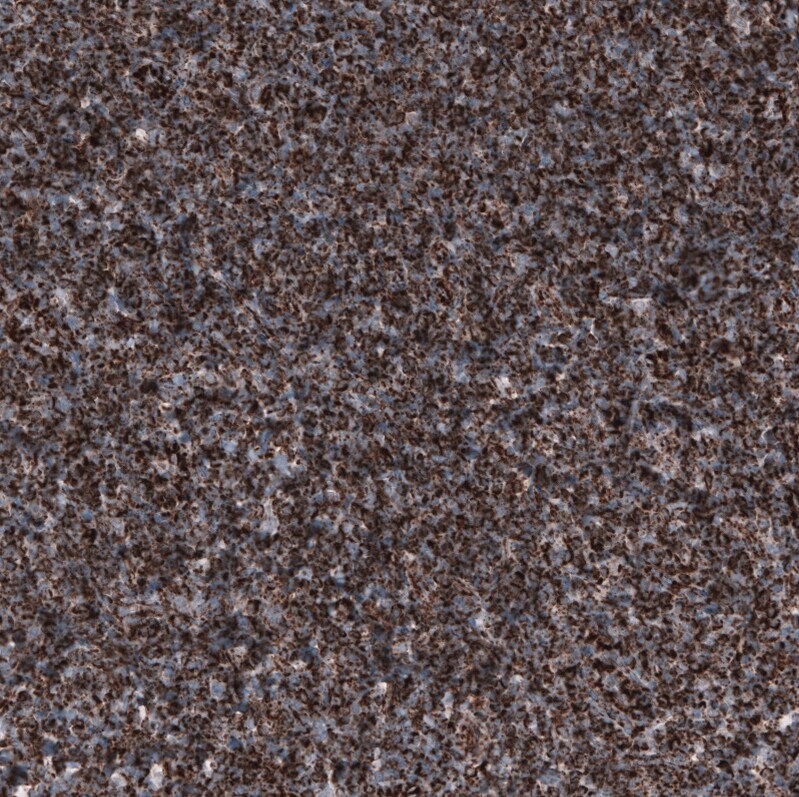 PBR Antibody (CL13358) - Azide and BSA Free Immunohistochemistry-Paraffin: PBR Antibody [NBP3-44381]