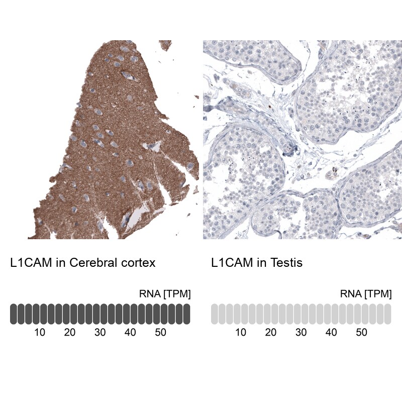 L1CAM Antibody (CL12988) - Azide and BSA Free Immunohistochemistry-Paraffin: L1CAM Antibody [NBP3-44382]