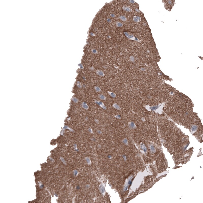 L1CAM Antibody (CL12988) - Azide and BSA Free Immunohistochemistry-Paraffin: L1CAM Antibody [NBP3-44382]