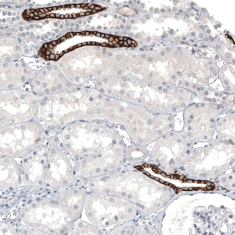 L1CAM Antibody (CL12988) - Azide and BSA Free Immunohistochemistry-Paraffin: L1CAM Antibody [NBP3-44382]