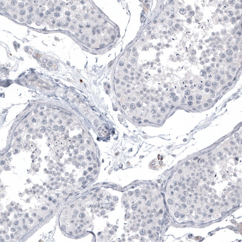 L1CAM Antibody (CL12988) - Azide and BSA Free Immunohistochemistry-Paraffin: L1CAM Antibody [NBP3-44382]