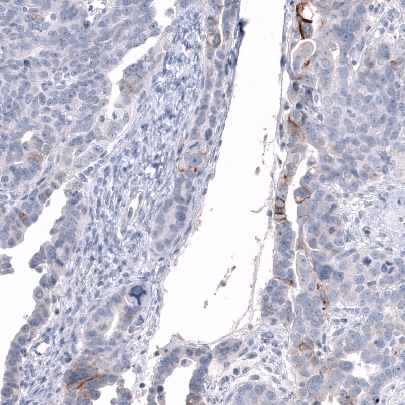 L1CAM Antibody (CL12988) - Azide and BSA Free Immunohistochemistry-Paraffin: L1CAM Antibody [NBP3-44382]
