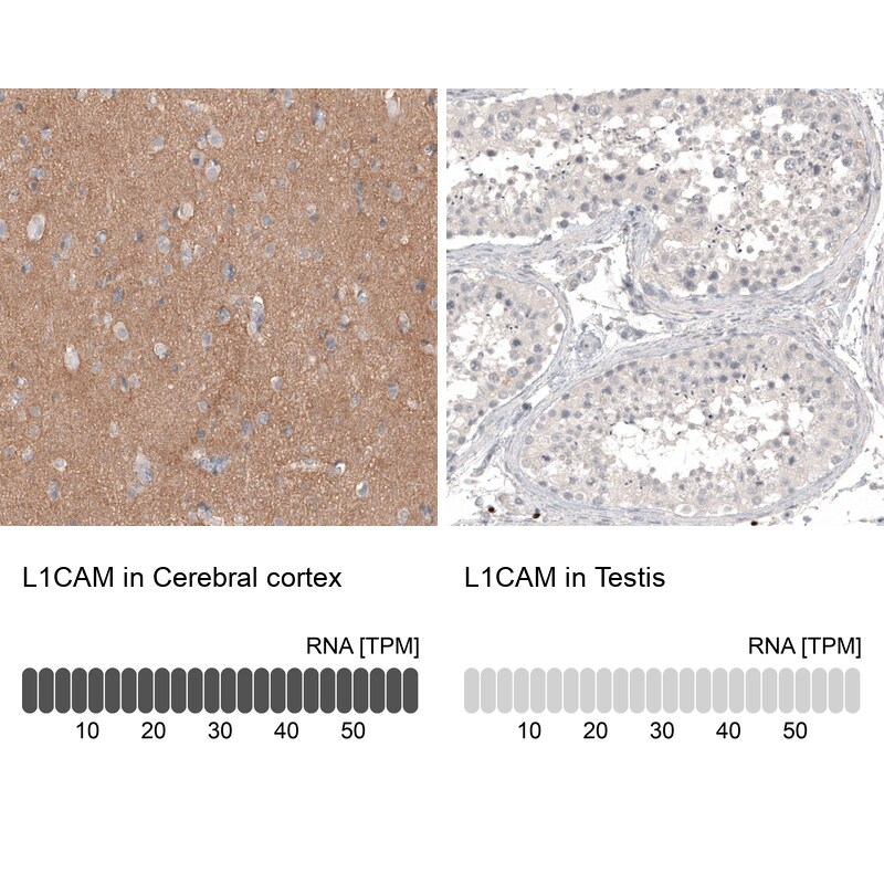 L1CAM Antibody (CL12984) - Azide and BSA Free Immunohistochemistry-Paraffin: L1CAM Antibody [NBP3-44383]
