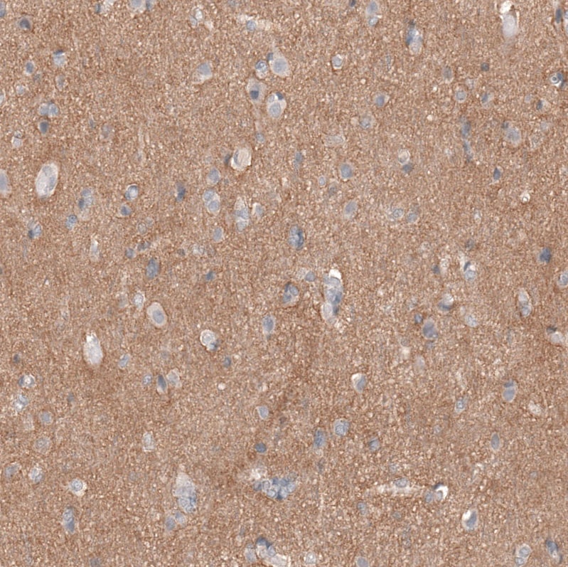 L1CAM Antibody (CL12984) - Azide and BSA Free Immunohistochemistry-Paraffin: L1CAM Antibody [NBP3-44383]