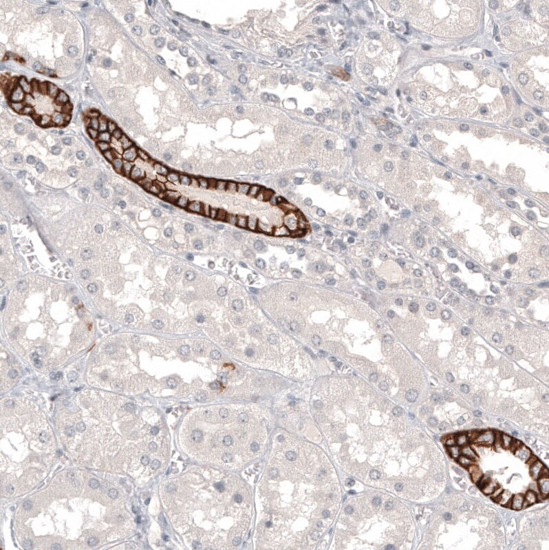 L1CAM Antibody (CL12984) - Azide and BSA Free Immunohistochemistry-Paraffin: L1CAM Antibody [NBP3-44383]