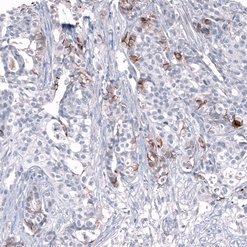 L1CAM Antibody (CL12984) - Azide and BSA Free Immunohistochemistry-Paraffin: L1CAM Antibody [NBP3-44383]