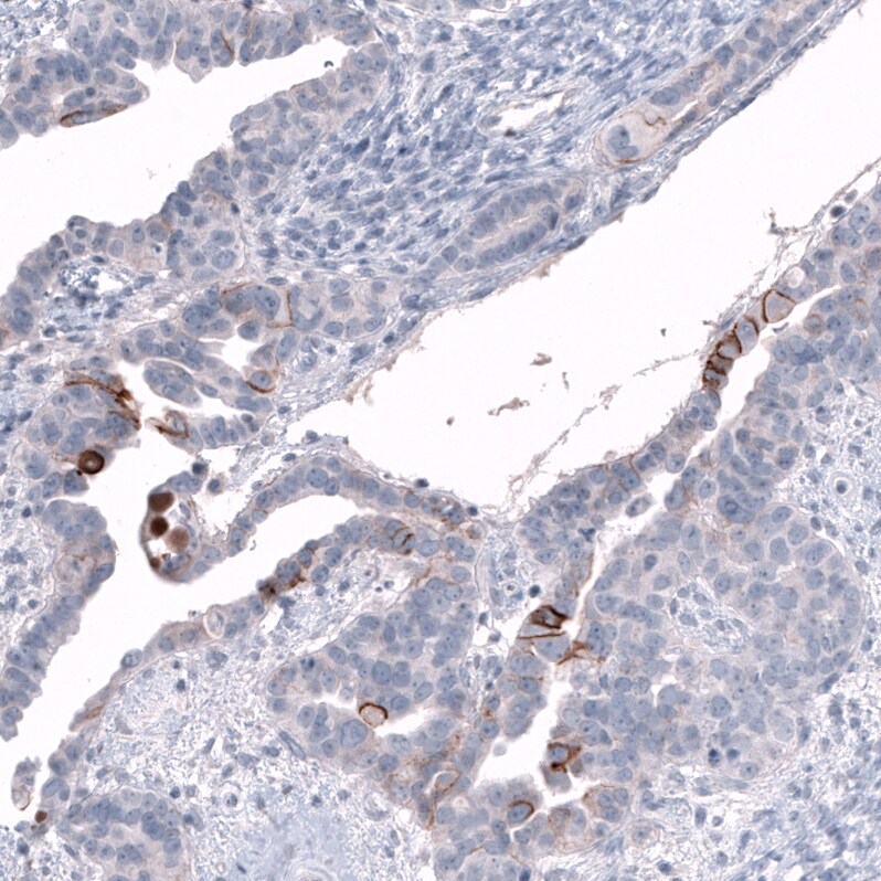 L1CAM Antibody (CL12984) - Azide and BSA Free Immunohistochemistry-Paraffin: L1CAM Antibody [NBP3-44383]