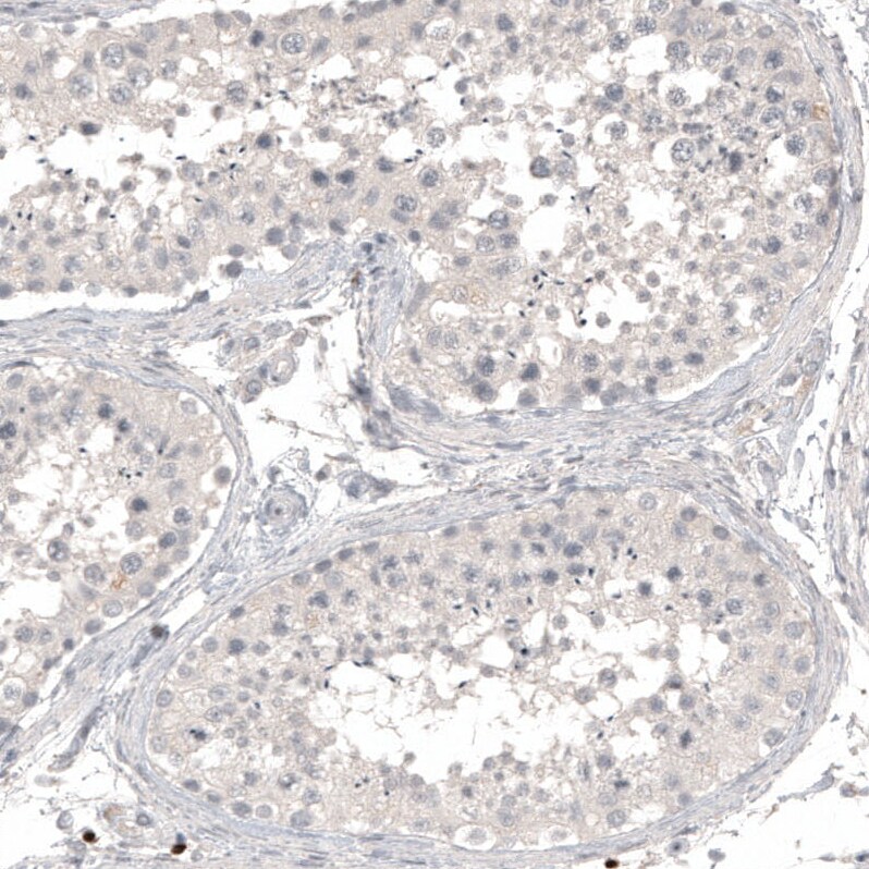 L1CAM Antibody (CL12984) - Azide and BSA Free Immunohistochemistry-Paraffin: L1CAM Antibody [NBP3-44383]