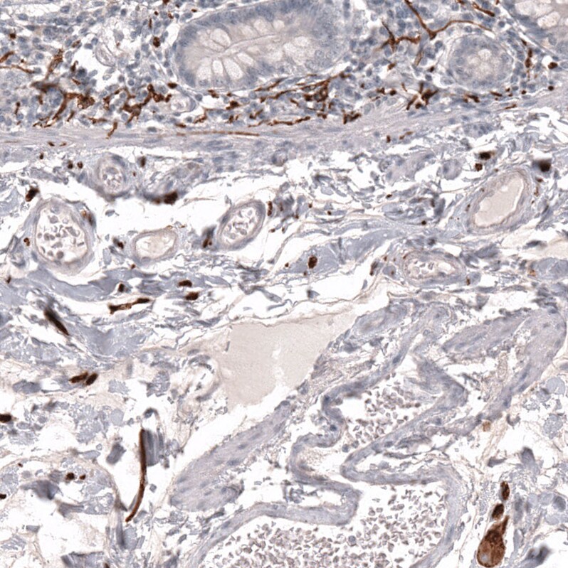 L1CAM Antibody (CL12984) - Azide and BSA Free Immunohistochemistry-Paraffin: L1CAM Antibody [NBP3-44383]