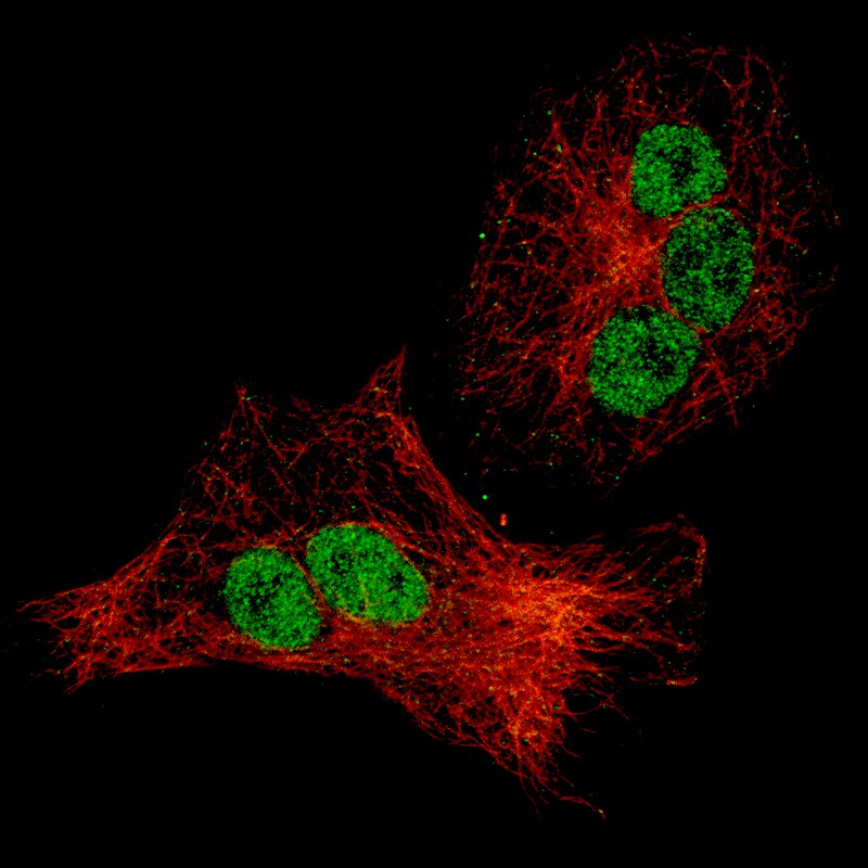 p21/CIP1/CDKN1A Antibody (CL13081) - Azide and BSA Free Immunocytochemistry/ Immunofluorescence: p21/CIP1/CDKN1A Antibody [NBP3-44384]