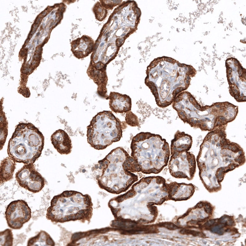 Glypican 3 Antibody (CL12711) - Azide and BSA Free Immunohistochemistry-Paraffin: Glypican 3 Antibody [NBP3-44385]