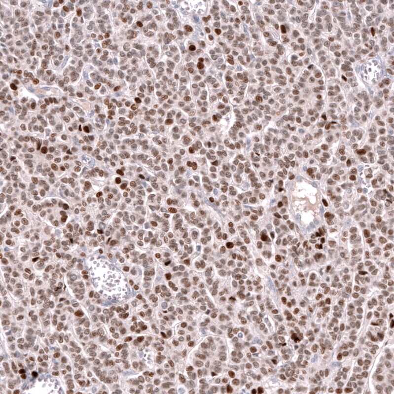 FOXL2 Antibody (CL12762) - Azide and BSA Free Immunohistochemistry-Paraffin: FOXL2 Antibody [NBP3-44386]