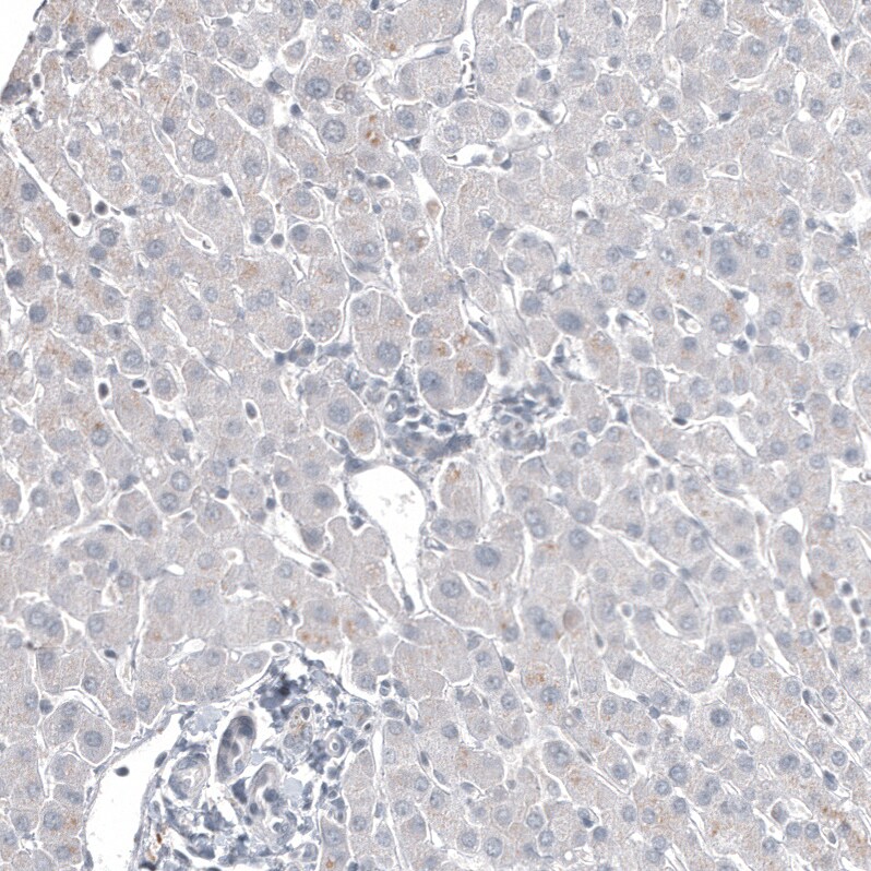 FOXL2 Antibody (CL12762) - Azide and BSA Free Immunohistochemistry-Paraffin: FOXL2 Antibody [NBP3-44386]