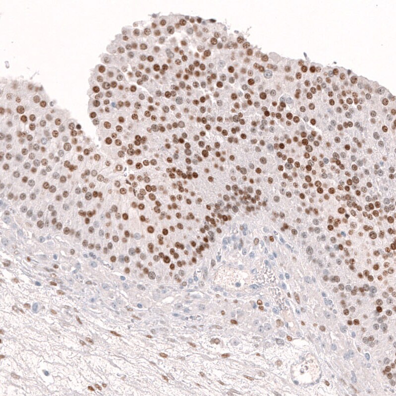 FOXL2 Antibody (CL12753) - Azide and BSA Free Immunohistochemistry-Paraffin: FOXL2 Antibody [NBP3-44387]