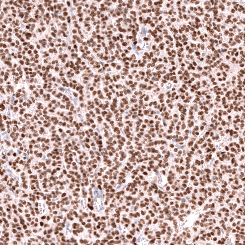 FOXL2 Antibody (CL12753) - Azide and BSA Free Immunohistochemistry-Paraffin: FOXL2 Antibody [NBP3-44387]