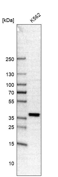 FOXL2 Antibody (CL12753) - Azide and BSA Free Western Blot: FOXL2 Antibody [NBP3-44387]